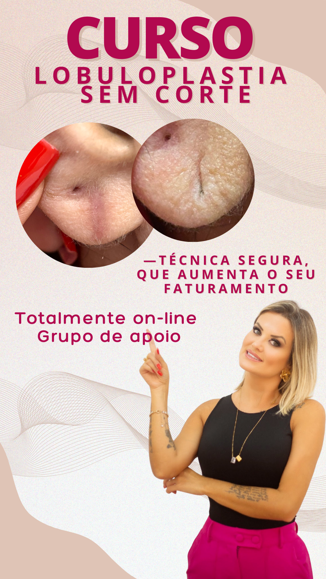 Lobuloplastia Sem Corte - Zero Intercorrência