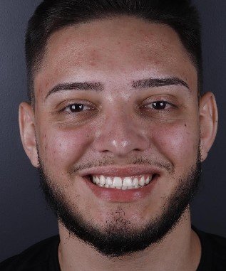 Zapp Rápido